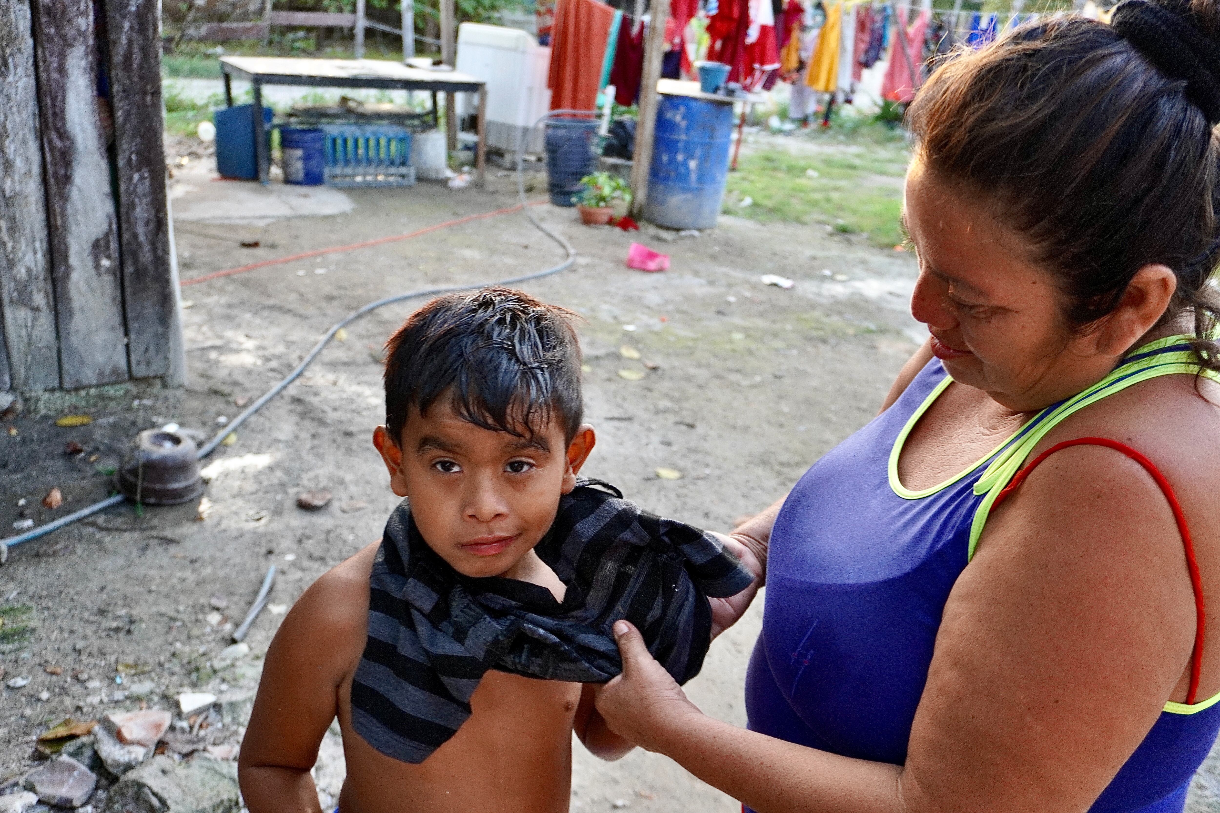 Abraham, alias Chiqui, necesita trabajos de cuidados especializados e intensos.