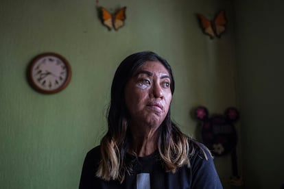 Esmeralda Millán, quien sobrevivió a un ataque con ácido de su expareja hace tres años cuando tenía 23 años, posa para un retrato en la casa de su abuela en el Estado de Puebla, el 22 de junio de 2021. En solo tres de los 32 Estados de México han clasificado los ataques con ácido contra mujeres como intento de feminicidio. Las sobrevivientes exigen ayuda con las innumerables cirugías que siguen y apoyo psicológico.