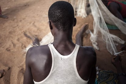 Um pescador com cicatrizes deixadas pelo Anti-balaka conserta uma rede, na ilha Longo, no distrito de Damara, em 1º de março de 2018.