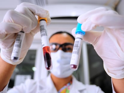 Una bióloga revisa dos muestras de sangre antes de analizarlas en Atlacomulco, México.