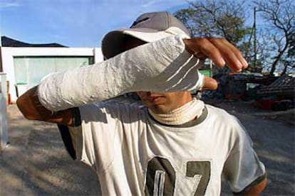 El Mahdi Belkacem muestra su brazo roto por la agresión que sufrió en Balanegra.