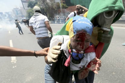 Agentes antidisturbios impiden con gases lacrimógenos el avance de manifestantes opositores hacia el centro de Caracas, quienes les respondían con piedras, en un nuevo brote de violencia en las protestas que dejan en un mes una treintena de muertos. En la imagen, una mujer herida es ayudada durante los enfrentamientos con las fuerzas de seguridad.