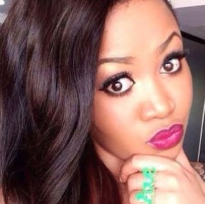 Vera Sidika em duas imagens que demonstram sua mudança de pele.