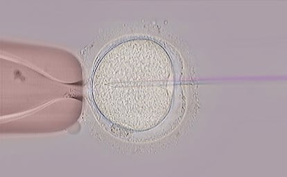 Técnica de fecundación in vitro de un ovocitos, en una imagen cedida por el Instituto Bernabéu.