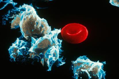 C&eacute;lulas con leucemia (izquierda) junto a un gl&oacute;bulo rojo.