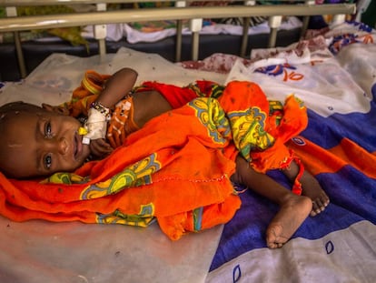 Un niño ingresado en la unidad de desnutrición de Liwa, en la región del Lago Chad (Chad).