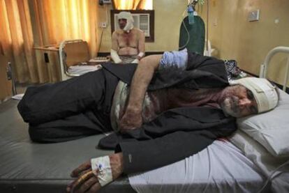 Dos heridos por la explosión de un coche bomba  en la ciudad santa de Nayaf descansan en un hospital.
