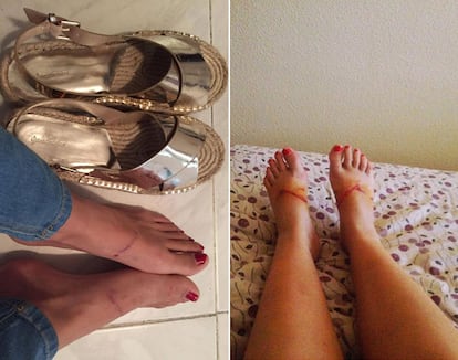 Muchas chicas se han animado a compartir el estado de sus pies en las redes sociales.