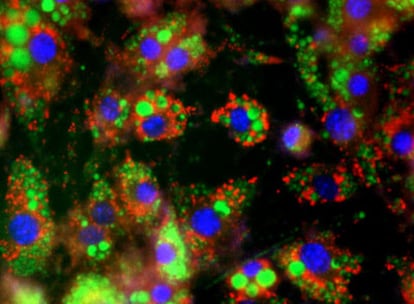 Los científicos han realizado por ingeniería genética células de grasa parda a partir de fibroblastos de piel utilizando dos factores genéticos clave.