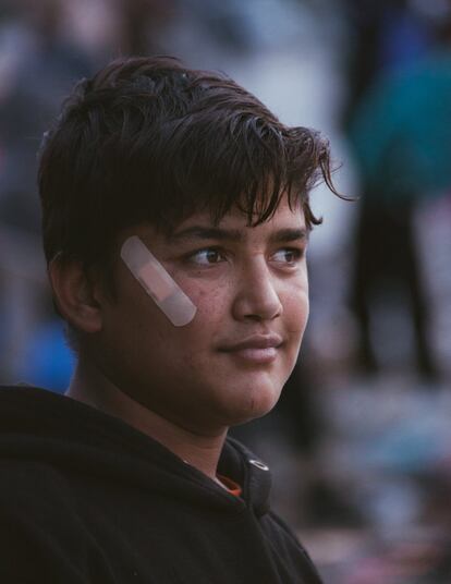 El fotógrafo hizo una serie sobre menores no acompañados, que, según cuenta, fueron los únicos que permanecieron temporalmente en el campamento después de que éste fuese desmantelado. El joven de la imagen es uno de ellos, aunque Franco nunca pudo saber su nombre. Según la agencia Reuters, en Calais se contabilizaron hasta 1.500 menores no acompañados.