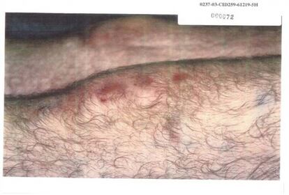 Imagen relevelada por el Pentágono, donde se aprecian hematomas en una rodilla