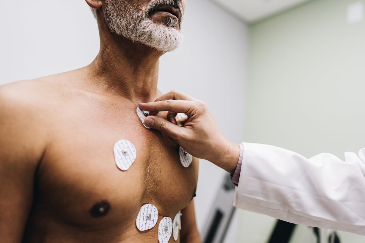 Arritmias: la vital importancia de detectarlas a tiempo e intervenir