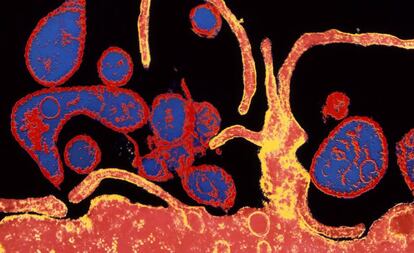 Microfotografía electrónica coloreada del virus del sarampión infectando una célula. 