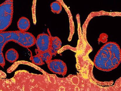 Microfotografía electrónica coloreada del virus del sarampión infectando una célula. 