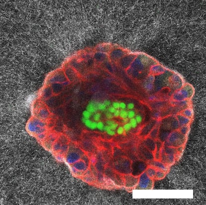 Imágenes de microscopía confocal de un embrión humano de 9 días de desarrollo.