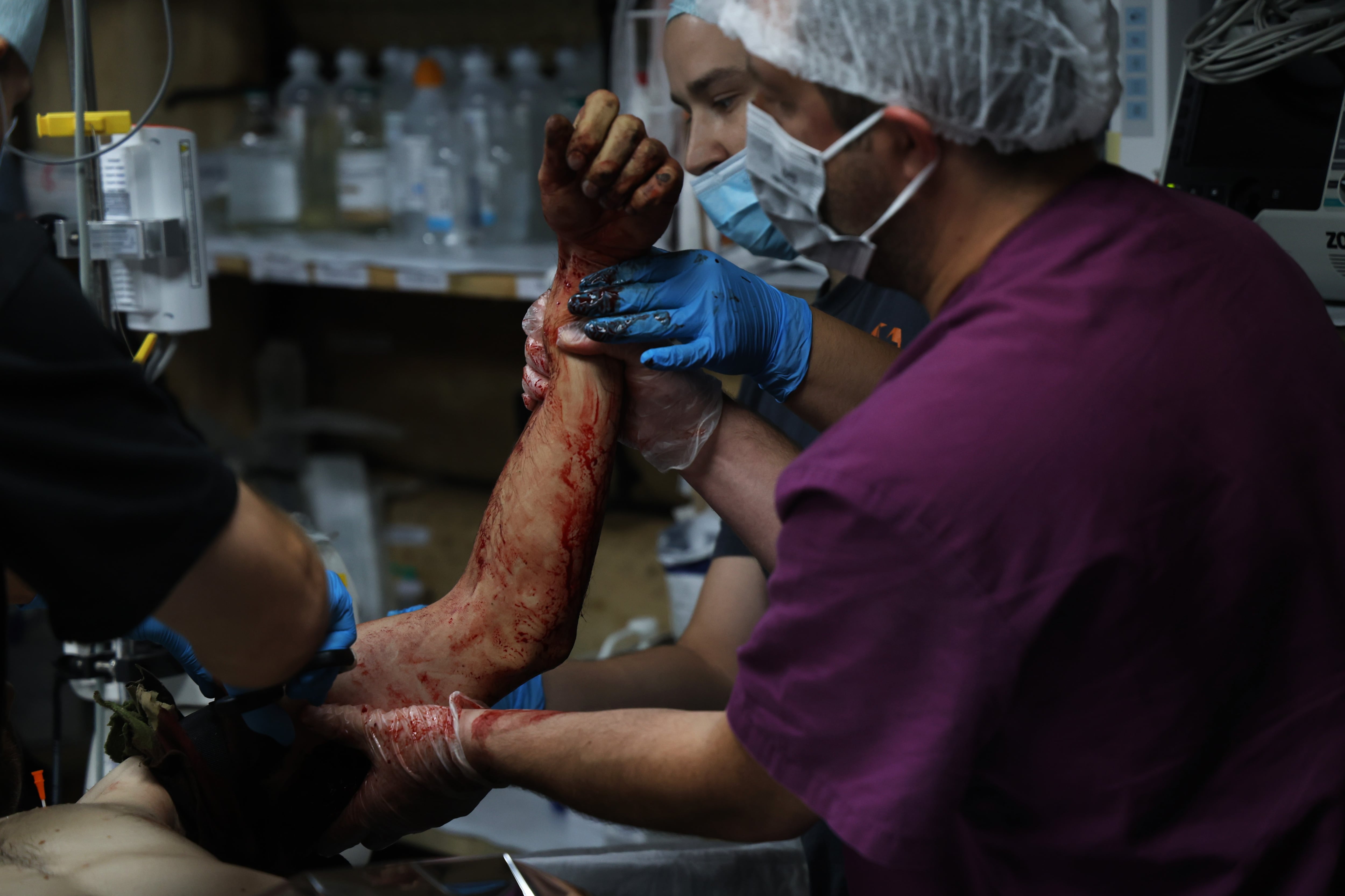 Un grupo de sanitarios atiende en un hospital subterráneo del frente de Pokrovsk (este de Ucrania) a un soldado herido por un dron.