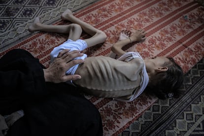Maryam Abdulaziz Mahmoud Davvas, de nueve años, sobre el suelo al haber perdido la habilidad para caminar por la desnutrición inducida por Israel.
