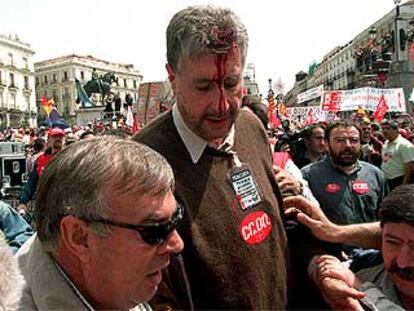 José María Fidalgo con el rostro ensangrentado, tras la agresión que sufrió el Primero de Mayo.