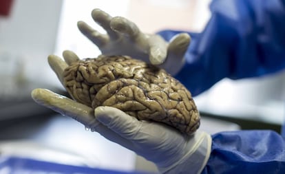 Un cerebro del Grupo de Neurociencias de la Universidade de Antioquia.