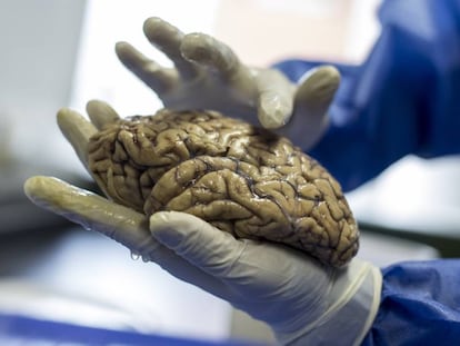 Un cerebro del Grupo de Neurociencias de la Universidade de Antioquia.