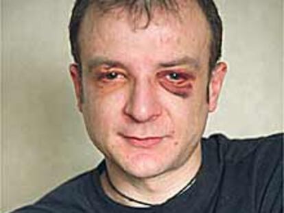 Javier Gómez, ayer, con el rostro marcado aún por la paliza.