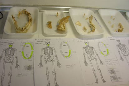 Algunas piezas dentales clasificadas