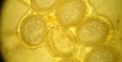 Huevos de 'taenia spp.' en el interior de la proglótide una tenia.