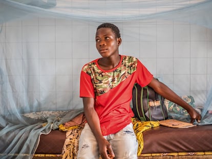 Kodzo N’tsakpoe, de 17 años, tiene úlcera de Buruli y fue abandonado por su madre en el hospital de Tsevié, en Togo, cuando manifestó la enfermedad, hace cuatro años.