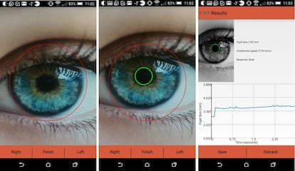 Aplicación móvil para medir pupilas desarrollada por la Universidad de Toronto.