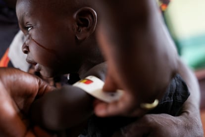 Un niño, atendido por un sanitario, en un centro médico en Bauchi (Nigeria), el 8 de mayo.