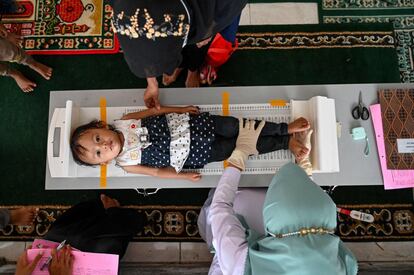 Miembros de un equipo sanitario miden la altura de una niña pequeña durante un chequeo médico masivo en un puesto de Banda Aceh, Indonesia.