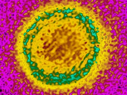 Un virus del dengue, visto con un microscopio electrónico.