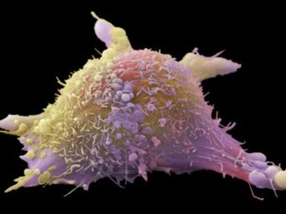 La Sociedad de Oncología Médica recuerda que el 40% de los tumores tienen causas evitables