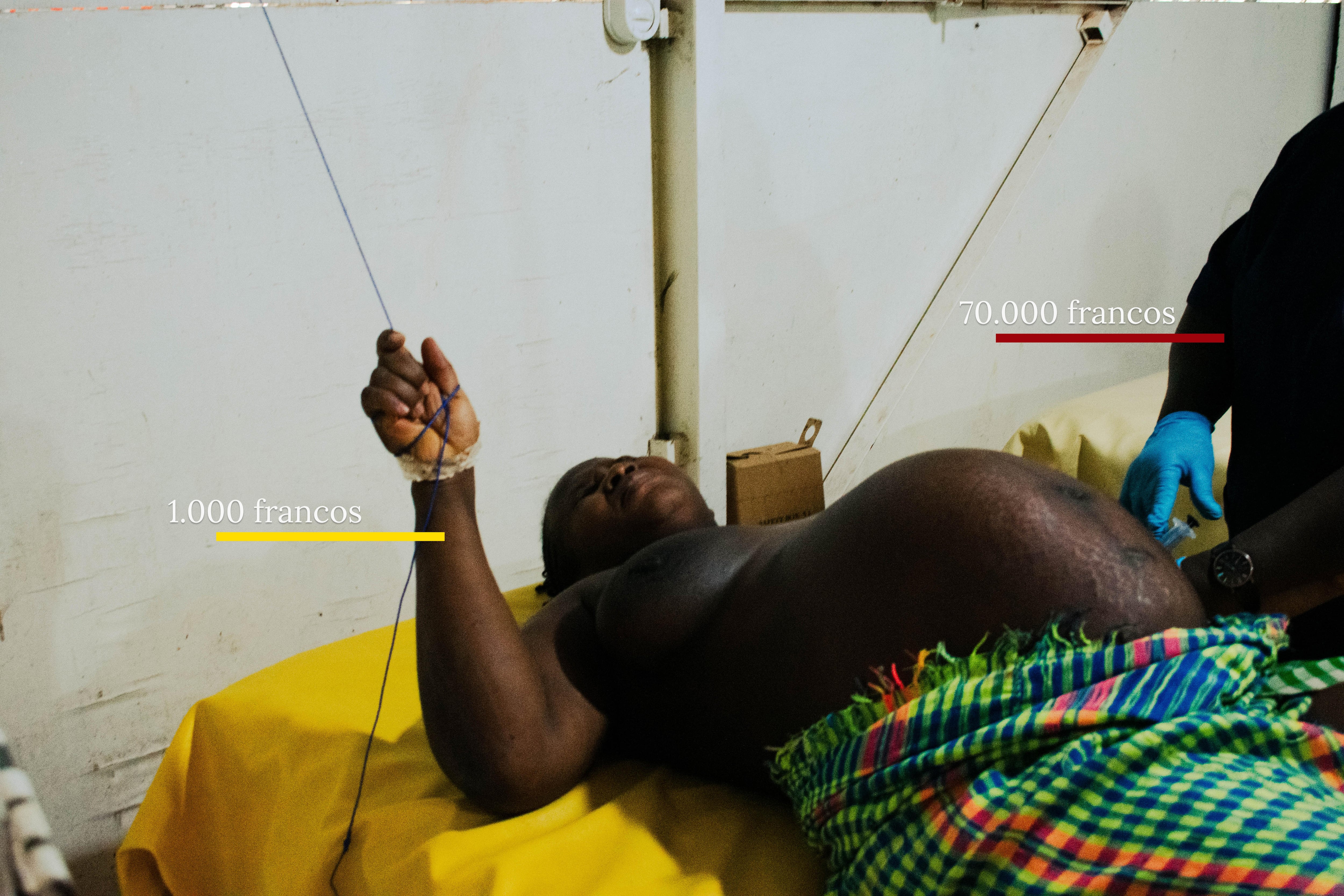 Aissato tiene contracciones, cada vez más frecuentes. A ratos pasea, a ratos se sienta. Tras más de una hora esperando, la familia llega y los médicos pueden empezar a prepararla. La cesárea cuesta 70.000 francos CFA (106 euros aproximadamente). Aissato no tiene ingresos; ha pagado su hermana Addiato, que es comercial. Ella gana 1.000 francos al día (1,52 euros). El nacimiento de su sobrino equivale a 70 días de trabajo.