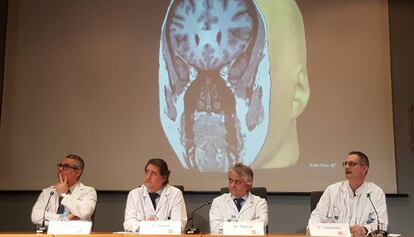 Los doctores Rodrigo Rocamora, Gerard Conesa, Julio Pascual y Jaume Capellades en la presentación de la ablación láser