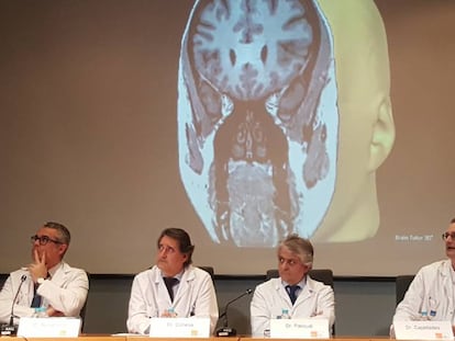 Los doctores Rodrigo Rocamora, Gerard Conesa, Julio Pascual y Jaume Capellades en la presentación de la ablación láser