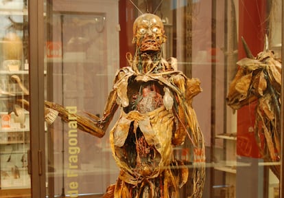 Uno de los cadáveres despellejados en el siglo XVIII y expuestos en el Museo Fragonard, a las afueras de París.