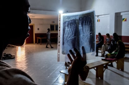 Un joven migrante muestra la radiografía de sus pies, fracturados tras cruzar la valla de la frontera de Argelia con Marruecos, en la ciudad fronteriza de Uchda.