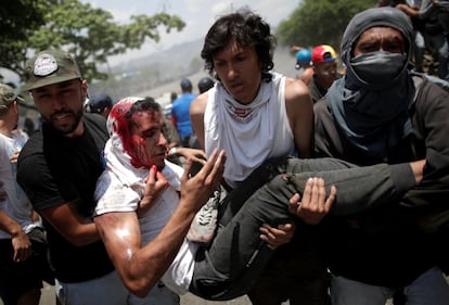 Un manifestante opositor con una herida abierta en la cabeza es transportado por otros opositores tras ser atropellado por un vehículo de la Guardia Nacional Bolivariana.