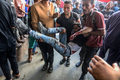 Palestinos heridos son trasladados al Hospital Nasser, este martes en Jan Yunis.