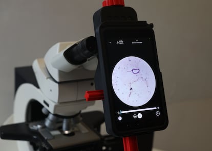 MultiplexAI malaria