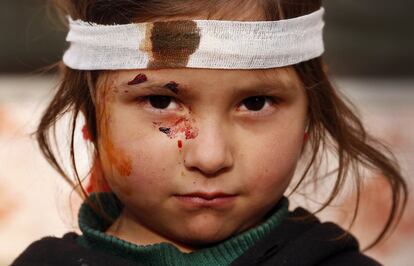 Una niña afgana, herida en el atentado del día anterior, posa para los fotógrafos en el lugar del suceso en Kabul (Afganistán). Los talibanes han reclamado la autoría de un atentado con coche bomba perpetrado la noche del lunes que causó al menos cuatro muertos y otros 113 heridos en una zona residencial frecuentada por extranjeros, en el este de Kabul.