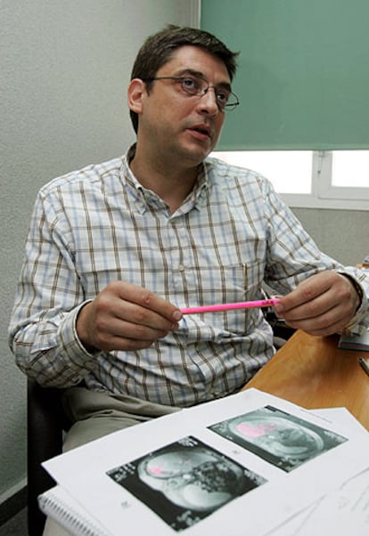 El físico Antonio Brú, ayer, en el departamento de Matemática Aplicada de la Universidad Complutense.