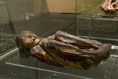 El TAC aplicado a las momias puede contar muchas cosas. Por ejemplo, cómo murió el hombre o mujer embalsamado. En el caso de la imagen, una momia andina del siglo VI d.C., su fallecimiento probablemente se debió a diversas fracturas craneales.