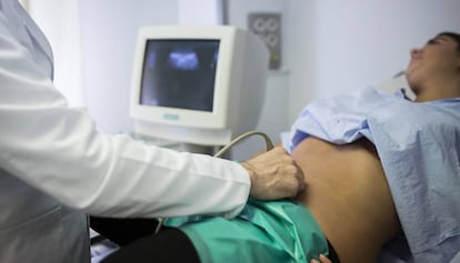 Un médico hace una ecografía a una mujer en el hospital Vall d'Hebron de Barcelona