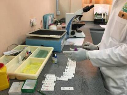 Tests rápidos de malaria en el laboratorio del hospital de Agamal en Obuasi (Ghana).