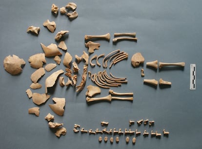 The remains of a child who died at 38 weeks of gestation. He had Down syndrome and died between 2,620 and 2,424 years ago in Alto de la Cruz, in present-day Navarra (Spain).