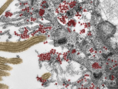 Pedaço de célula da mucosa olfativa observada ao microscópio, com as partículas do coronavírus destacadas em vermelho (a cor não é real).