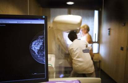 Un t&eacute;cnico realiza una mamograf&iacute;a a una paciente