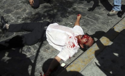 Marcelino Coache, líder del sindicato de profesores, herido en la manifestación.